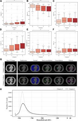 Computed tomography-based imaging biomarker identifies coal workers’ pneumoconiosis